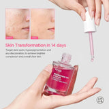 Anua - Niacinamide 10% TXA 4% Dark Spot Correcting Serum